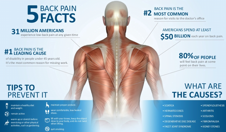 Causes of Sciatica pain