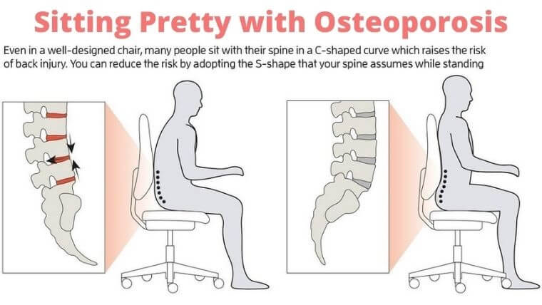 Sitting Pretty with Osteoporosis