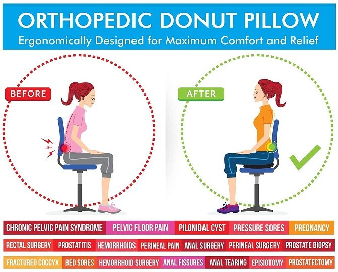 How Donut Seat Pillow is benificial for Piles - Infographic